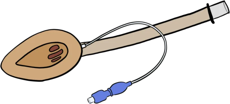 A laryngeal mask airway (second generation)
